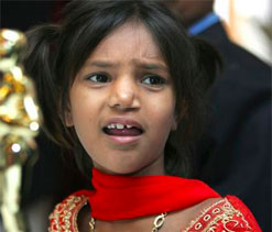 Smile Train patient Pinki Sonkar to flip coin at Wimbledon
